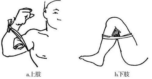 止血带止血法视频
